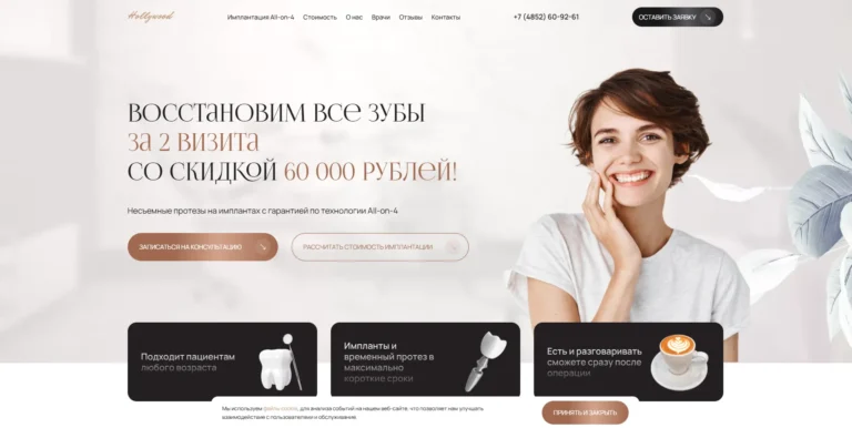 Имплантация зубов All-on-4 «Голливуд»