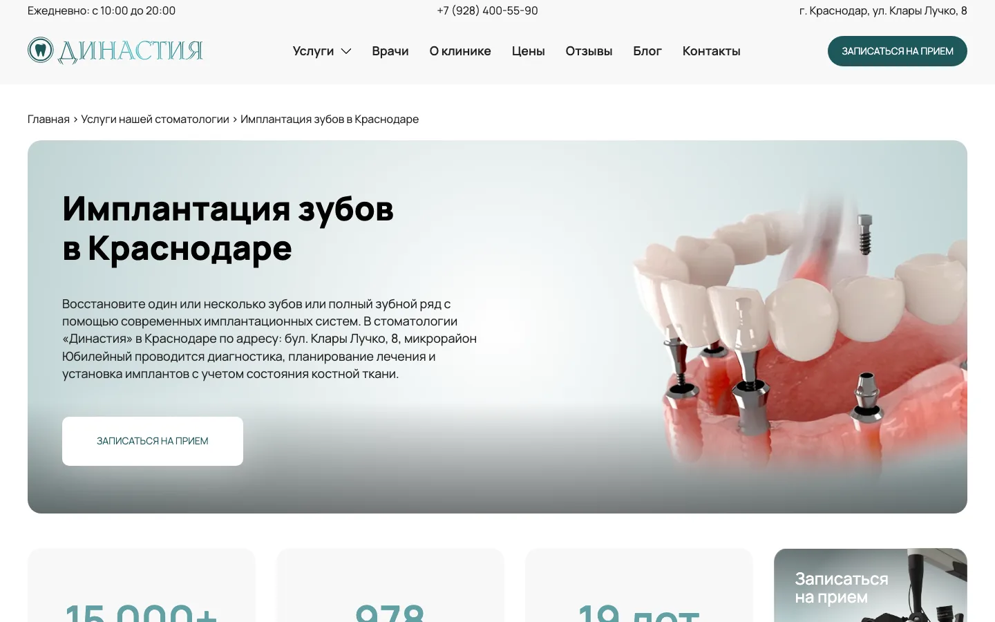 Страница имплантации зубов на сайте стоматологии «Династия»