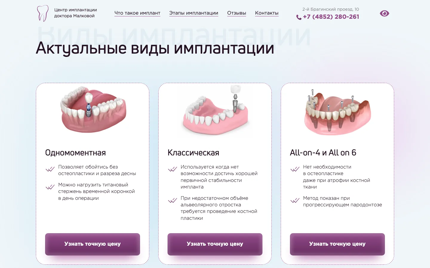 Карточки видов имплантации: одномоментная, классическая, All-on-4 и All-on-6