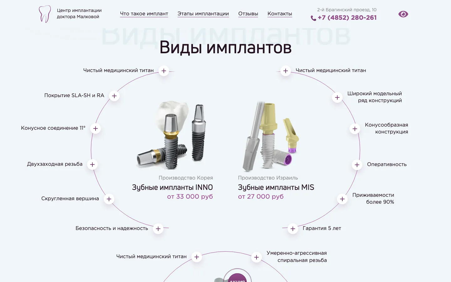 Блок «Виды имплантов» с ценами INNO и MIS на лендинге «Милана»