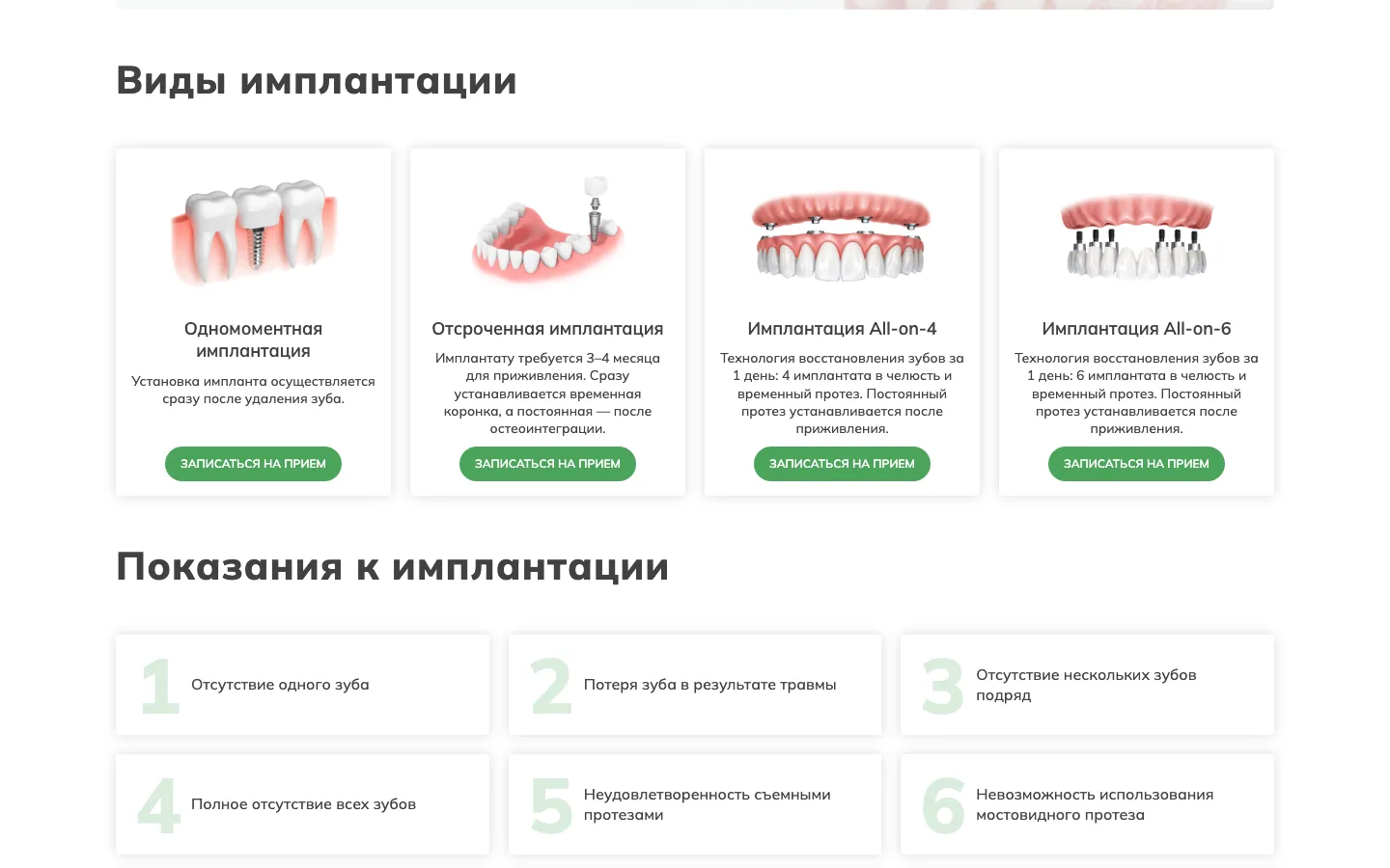 Страница имплантации зубов на сайте «ММ-Клиник»: одномоментная, отсроченная, All-on-4 и All-on-6