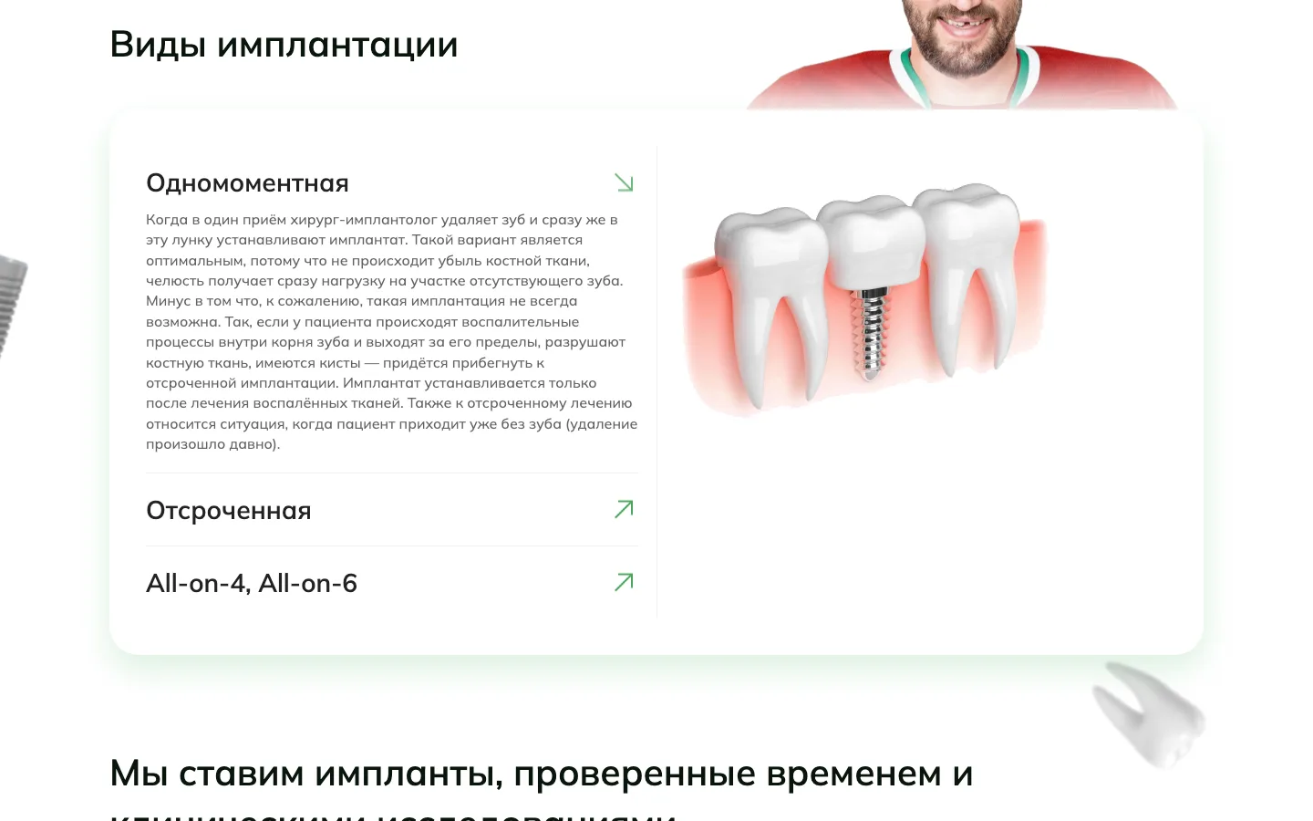 Блок «Виды имплантации» на лендинге «ММ-Клиник»: одномоментная, отсроченная, All-on-4