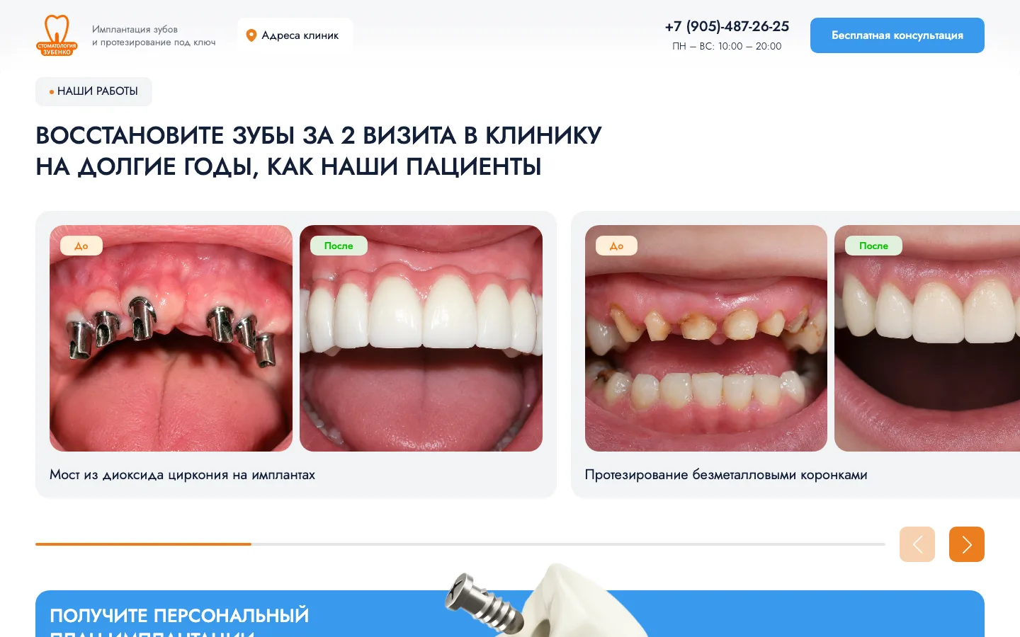 Галерея работ «до/после» на лендинге стоматологии Зубенко